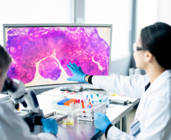AI in Pathology: From Digital Slides to Decision Support